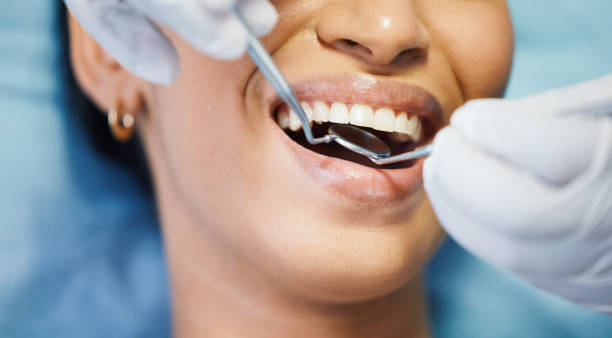 Best Emergency Root Canal Treatment in Monrovia, MD