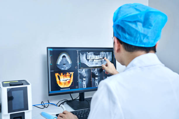 Best Emergency Wisdom Teeth Removal in Monrovia, MD